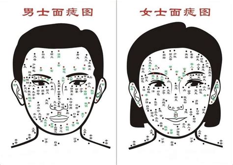 有臉頰有痣|超準面相心理測驗！臉上痣位置意義、愛情觀「淚痣、。